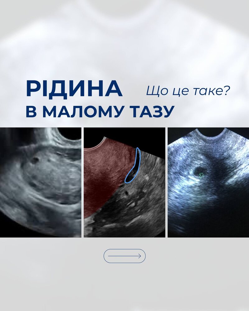 Слайд 1: Що це таке?